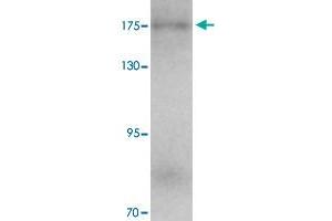Western blot analysis of KIAA0196 in human ovary tissue with KIAA0196 polyclonal antibody  at 1 ug/mL. (Strumpellin anticorps  (C-Term))