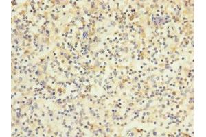 Immunohistochemistry of paraffin-embedded human spleen tissue using ABIN7175617 at dilution of 1:100
