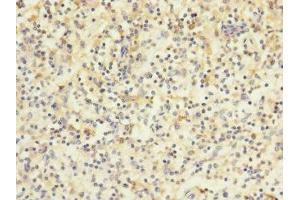 Immunohistochemistry of paraffin-embedded human spleen tissue using ABIN7175617 at dilution of 1:100 (HVCN1 anticorps  (AA 1-100))