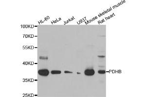 Western blot analysis of extracts of various cell lines, using PDHB antibody (ABIN5975451) at 1/1000 dilution. (PDHB anticorps)