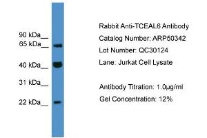 WB Suggested Anti-TCEAL6  Antibody Titration: 0. (TCEAL6 anticorps  (C-Term))