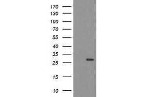 Image no. 1 for anti-THAP Domain Containing 6 (THAP6) antibody (ABIN1501373) (THAP6 anticorps)