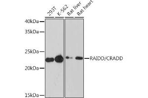 Western blot analysis of extracts of various cell lines, using RAIDD/CRADD Rabbit mAb (ABIN7266107) at 1:1000 dilution. (CRADD anticorps)