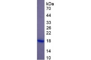 SDS-PAGE of Protein Standard from the Kit (Highly purified E. (RPN1 Kit ELISA)
