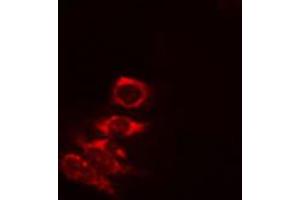 ABIN6274823 staining COLO205 cells by IF/ICC.