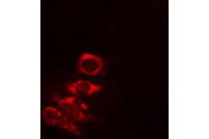 ABIN6274823 staining COLO205 cells by IF/ICC. (AKR1A1 anticorps  (C-Term))