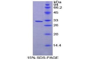 SDS-PAGE (SDS) image for Prolylcarboxypeptidase (PRCP) (AA 113-350) protein (His tag) (ABIN1878994)