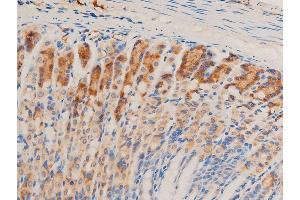 ABIN6267067 at 1/100 staining mouse gastric tissue sections by IHC-P.