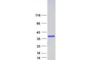 Validation with Western Blot