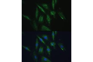 Immunofluorescence analysis of H9C2 cells using SRPRB antibody (ABIN6132685, ABIN6148459, ABIN6148460 and ABIN6214895) at dilution of 1:100. (SRPRB anticorps  (AA 57-271))