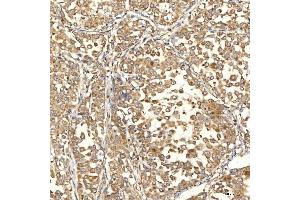 IHC analysis of Citrin/SLC25A13 using anti-Citrin/SLC25A13 antibody (ABIN7599512). (slc25a13 anticorps  (AA 1-643))