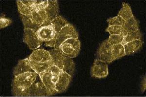 Immunofluorescence staining of A431 cells. (RABEP1 anticorps  (AA 247-417))