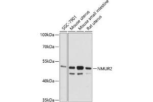 Western blot analysis of extracts of various cell lines, using NMUR2 antibody (ABIN6128345, ABIN6144693, ABIN6144694 and ABIN6216572) at 1:3000 dilution. (NMUR2 anticorps  (AA 326-415))