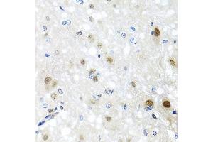 Immunohistochemistry of paraffin-embedded rat brain using SAFB2 antibody at dilution of 1:100 (x40 lens). (SAFB2 anticorps)