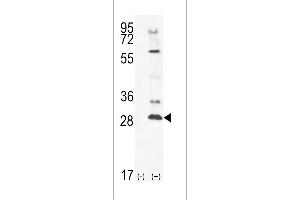 Western blot analysis of TSSK4 using rabbit polyclonal TSSK4 Antibody using 293 cell lysates (2 ug/lane) either nontransfected (Lane 1) or transiently transfected (Lane 2) with the TSSK4 gene. (TSSK4 anticorps  (C-Term))