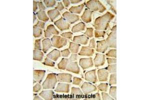 Formalin-fixed and paraffin-embedded human skeletal muscle reacted with PIK4CB Antibody (Center), which was peroxidase-conjugated to the secondary antibody, followed by DAB staining.
