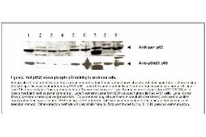 Image no. 2 for anti-Nuclear Factor-kB p65 (NFkBP65) (pSer529) antibody (ABIN116929) (NF-kB p65 anticorps  (pSer529))