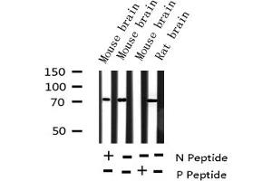Western blot analysis of Phospho-FKHR (Ser256) expression in various lysates