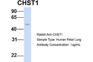 Host: Rabbit Target Name: CHST1 Sample Type: Human Fetal Lung Antibody Dilution: 1. (CHST1 anticorps  (Middle Region))
