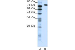 WB Suggested Anti-SATB1 Antibody Titration:  1. (SATB1 anticorps  (C-Term))