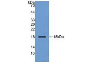 Detection of Recombinant ADP, Bovine using Polyclonal Antibody to Adiponectin (ADPN) (ADIPOQ anticorps  (AA 103-240))