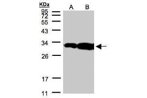 WB Image Sample(30 μg of whole cell lysate) A:Hep G2, B:MOLT4, 12% SDS PAGE antibody diluted at 1:500 (HOXC11 anticorps)