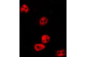 ABIN6274018 staining HepG2 by IF/ICC. (Histone 3 anticorps  (H3K14me, H3K14me2, H3K14me3))