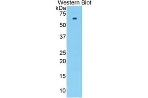 WB of Protein Standard: different control antibodies  against Highly purified E. (TNNC2 Kit ELISA)