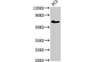 Western Blot Positive WB detected in: PC-3 whole cell lysate All lanes: ICK antibody at 3 μg/mL Secondary Goat polyclonal to rabbit IgG at 1/50000 dilution Predicted band size: 72, 35 kDa Observed band size: 72 kDa (ICK anticorps  (AA 150-275))