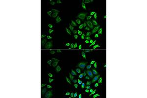 Immunofluorescence analysis of U2OS cells using PLA2G2D antibody (ABIN5974308). (PLA2G2D anticorps)