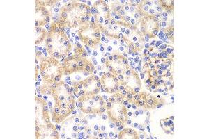 Immunohistochemistry of paraffin-embedded rat kidney using SHMT2 Antibody.