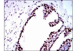 Immunohistochemistry (IHC) image for anti-Replication Protein A1, 70kDa (RPA1) antibody (ABIN1846411) (RPA1 anticorps)