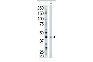 The anti-ART3 Pab (ABIN389010 and ABIN2839235) is used in Western blot to detect ART3 in mouse brain tissue lysate. (ART3 anticorps  (N-Term))