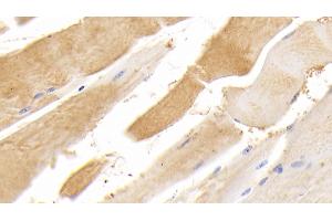 Detection of TTN in Human Skeletal muscle Tissue using Polyclonal Antibody to Titin (TTN) (Titin anticorps  (AA 33779-34025))