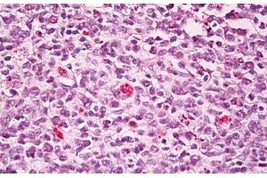 Anti-SWAP70 antibody IHC staining of human tonsil, germinal center. (SWAP70 anticorps  (AA 1-50))