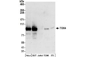 anti-TOX High Mobility Group Box Family Member 4 (TOX4) (AA 25-75) antibody