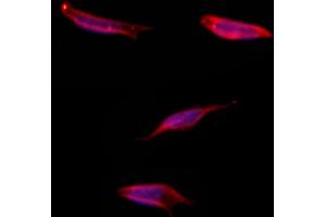 ABIN6265040 and ABIN6273317 staining Hela by IF/ICC.
