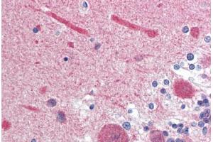 anti-Calmodulin 1 (Calm1) (AA 1-149) antibody