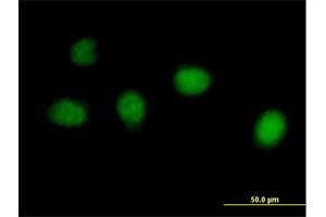 Immunofluorescence of purified MaxPab antibody to C1orf73 on HeLa cell. (INTS7 anticorps  (AA 1-962))