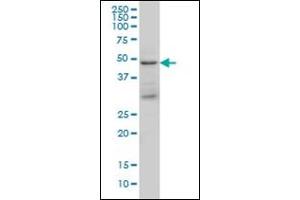 Western Blotting (WB) image for anti-Tumor Susceptibility Gene 101 (TSG101) antibody (ABIN781822)