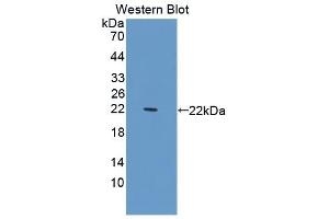 Detection of Recombinant C1INH, Rat using Polyclonal Antibody to Complement 1 Inhibitor (C1INH) (SERPING1 anticorps  (AA 148-270))