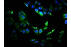 Immunofluorescence staining of Hela cells with ABIN7170532 at 1:200, counter-stained with DAPI. (VIPAR anticorps  (AA 1-493))
