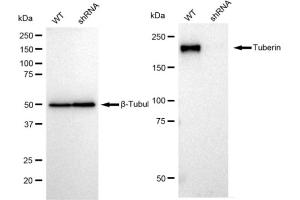 Western blotting analysis using Tuberin antibody (ABIN7800658).