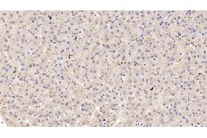 Detection of COMT in Human Liver Tissue using Polyclonal Antibody to Catechol-O-Methyltransferase (COMT)