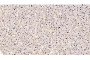 Detection of COMT in Human Liver Tissue using Polyclonal Antibody to Catechol-O-Methyltransferase (COMT) (COMT anticorps  (AA 52-271))