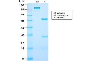 anti-Prostate Specific Antigen (PSA) antibody