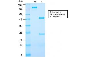 SDS-PAGE Analysis Purified PSA Rabbit Recombinant Monoclonal Antibody (KLK3/2871R). (Recombinant Prostate Specific Antigen anticorps)