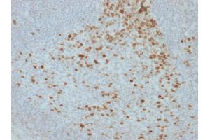 Formalin-fixed, paraffin-embedded human Lymph Node stained with Proliferation Marker Mouse Monoclonal Antibody (JC1). (Proliferation Marker anticorps)