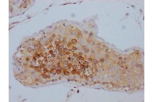 IHC image of ABIN7127834 diluted at 1:100 and staining in paraffin-embedded human testis tissue performed on a Leica BondTM system. (Recombinant TACC3 anticorps)