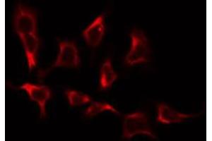 ABIN6274923 staining COLO205 by IF/ICC. (BRP44L anticorps  (Internal Region))
